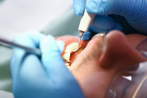 Best Broken Tooth Emergency  in Iyanbito, NM