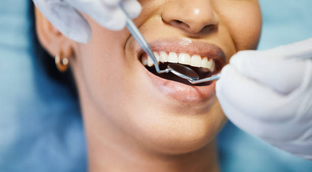 Best Knocked-Out Tooth Emergency  in Iyanbito, NM