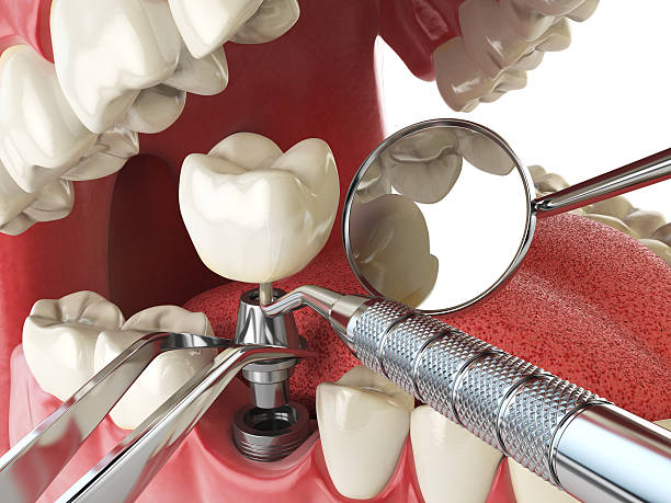 Best Cracked Tooth Emergency Dentist  in Iyanbito, NM