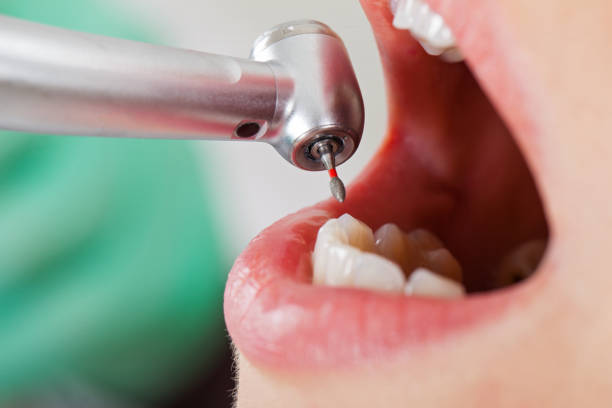 Best Broken Tooth Emergency  in Iyanbito, NM